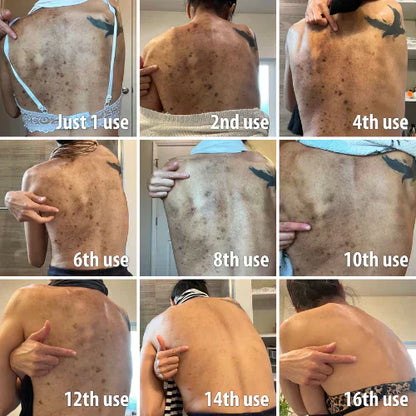 ✨Seurico™ Rapid Dark Spot Eraser – Melanin Correcting Facial Serum🔥