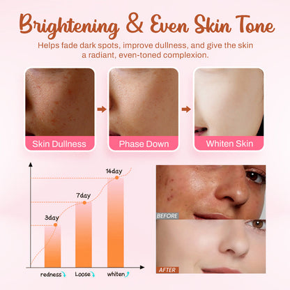 NEGUSY™ Whitening and Freckle - Removing Mask