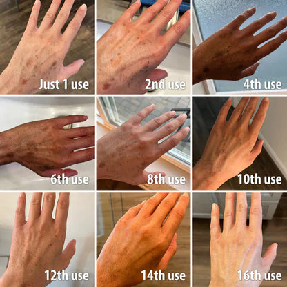 ✨Seurico™ Rapid Dark Spot Eraser – Melanin Correcting Facial Serum🔥