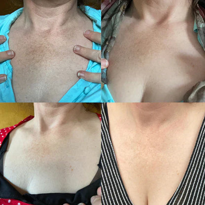 ✨Seurico™ Rapid Dark Spot Eraser – Melanin Correcting Facial Serum🔥