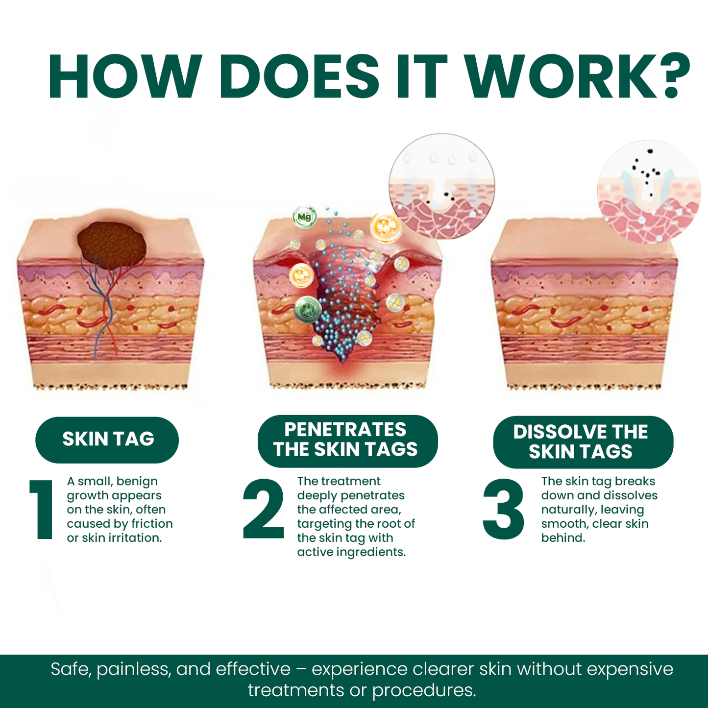 🔥LAST DAY 80% OFF - LBMLBM® Magnesium Micro-pin Wart Removal Patch