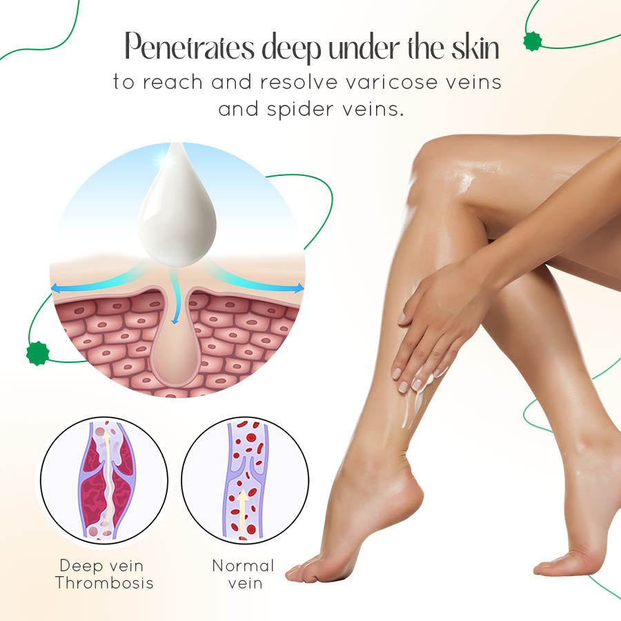 VasCulear™ Clinically-Inspired Vein Therapy Cream（Supports healthier-looking legs & vein appearance）