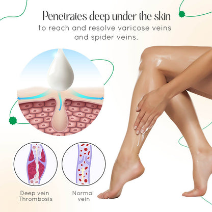 VasCulear™ Clinically-Inspired Vein Therapy Cream（Supports healthier-looking legs & vein appearance）