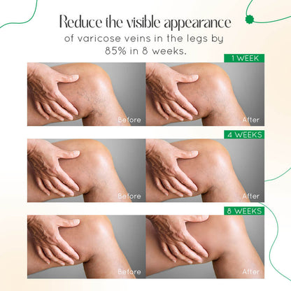VasCulear™ Clinically-Inspired Vein Therapy Cream（Supports healthier-looking legs & vein appearance）