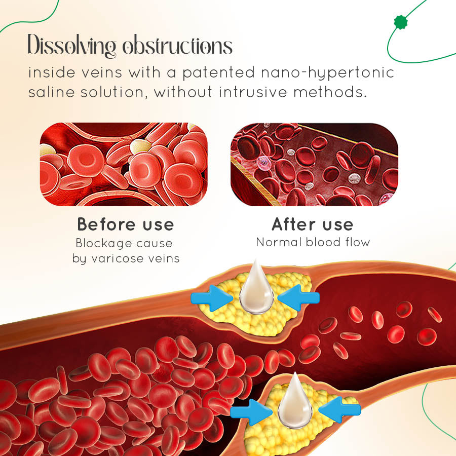 VasCulear™ Clinically-Inspired Vein Therapy Cream（Supports healthier-looking legs & vein appearance）