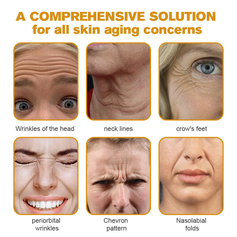 (Made and Shipped from USA) 🧑‍⚕️NEGUSY® Botox Bee Venom Wrinkle Removal Cream